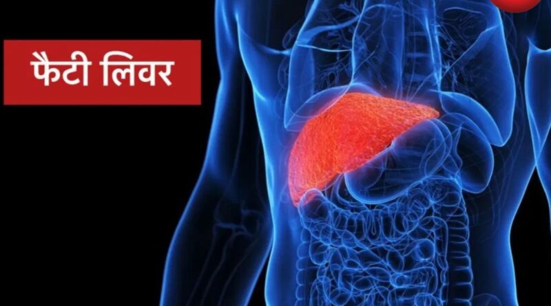 फैटी लिवर