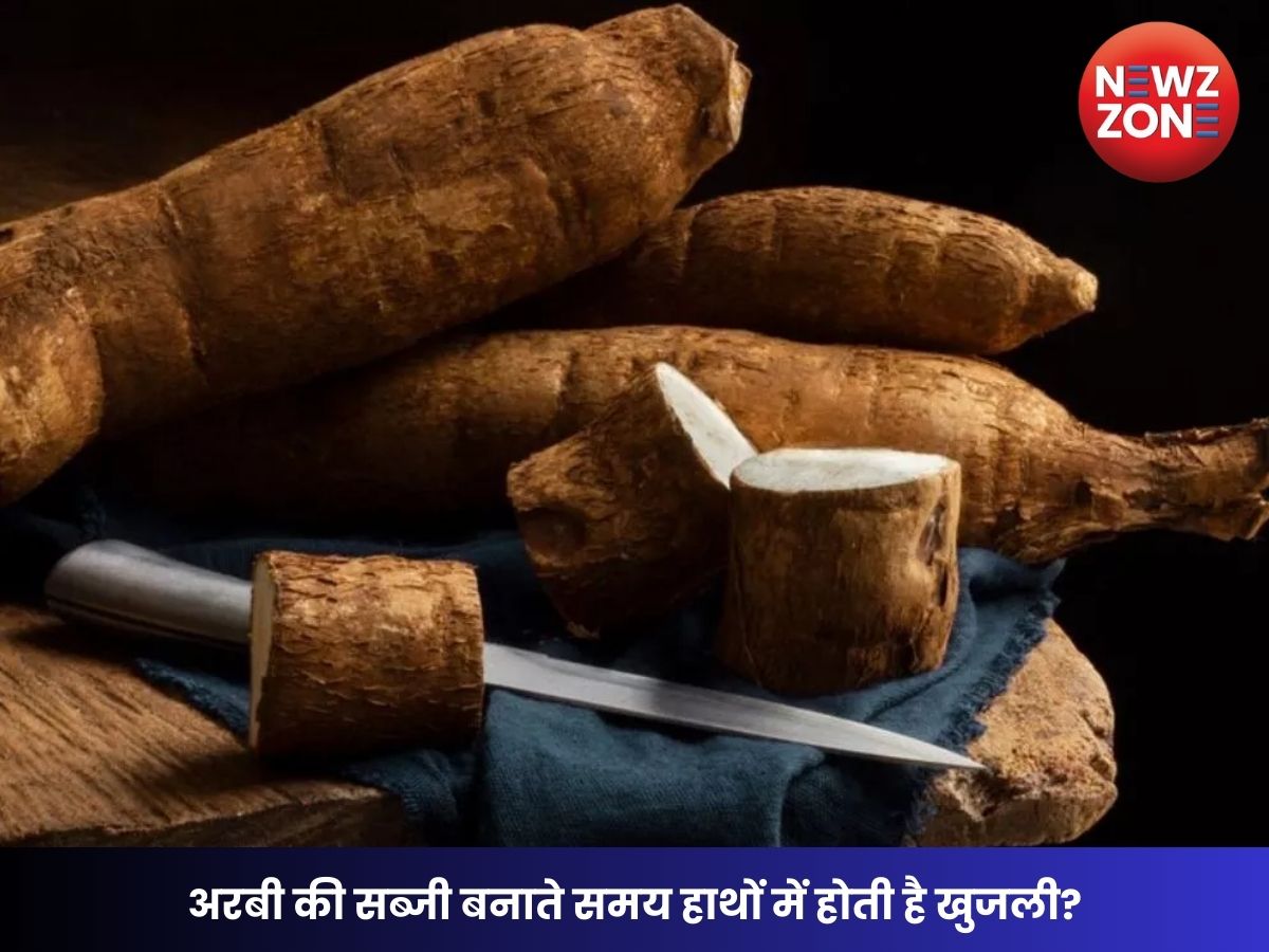 अरबी की सब्जी बनाते समय हाथों में होती है खुजली? तो अब डरने की ज़रूरत नहीं! अपनाएं ये 5 आसान घरेलू उपाय
