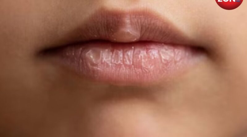 Lips Care Tips In Winter