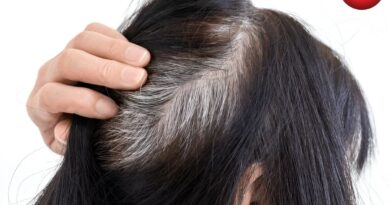 Natural remedies for white hair