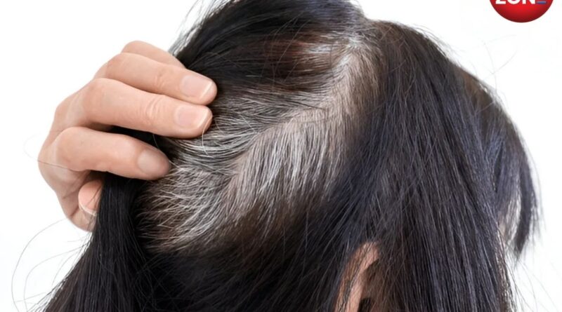 Natural remedies for white hair