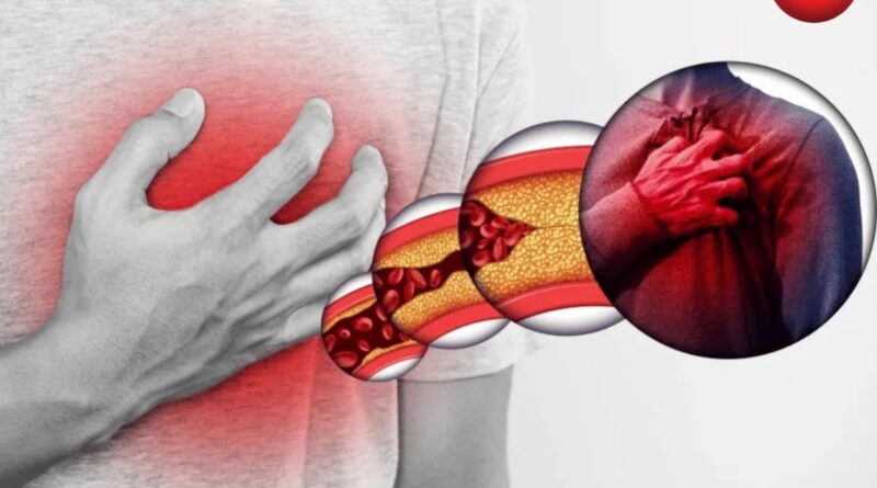 AIIMS Heart Disease Study