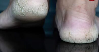 Winter Heel Care Tips