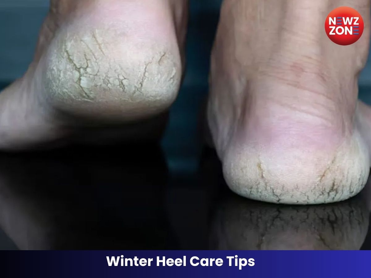 Winter Heel Care Tips