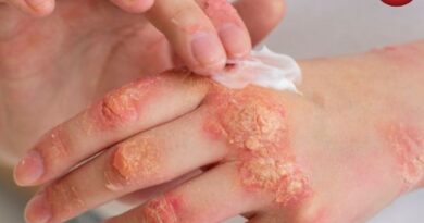 Fungal Infections Alert