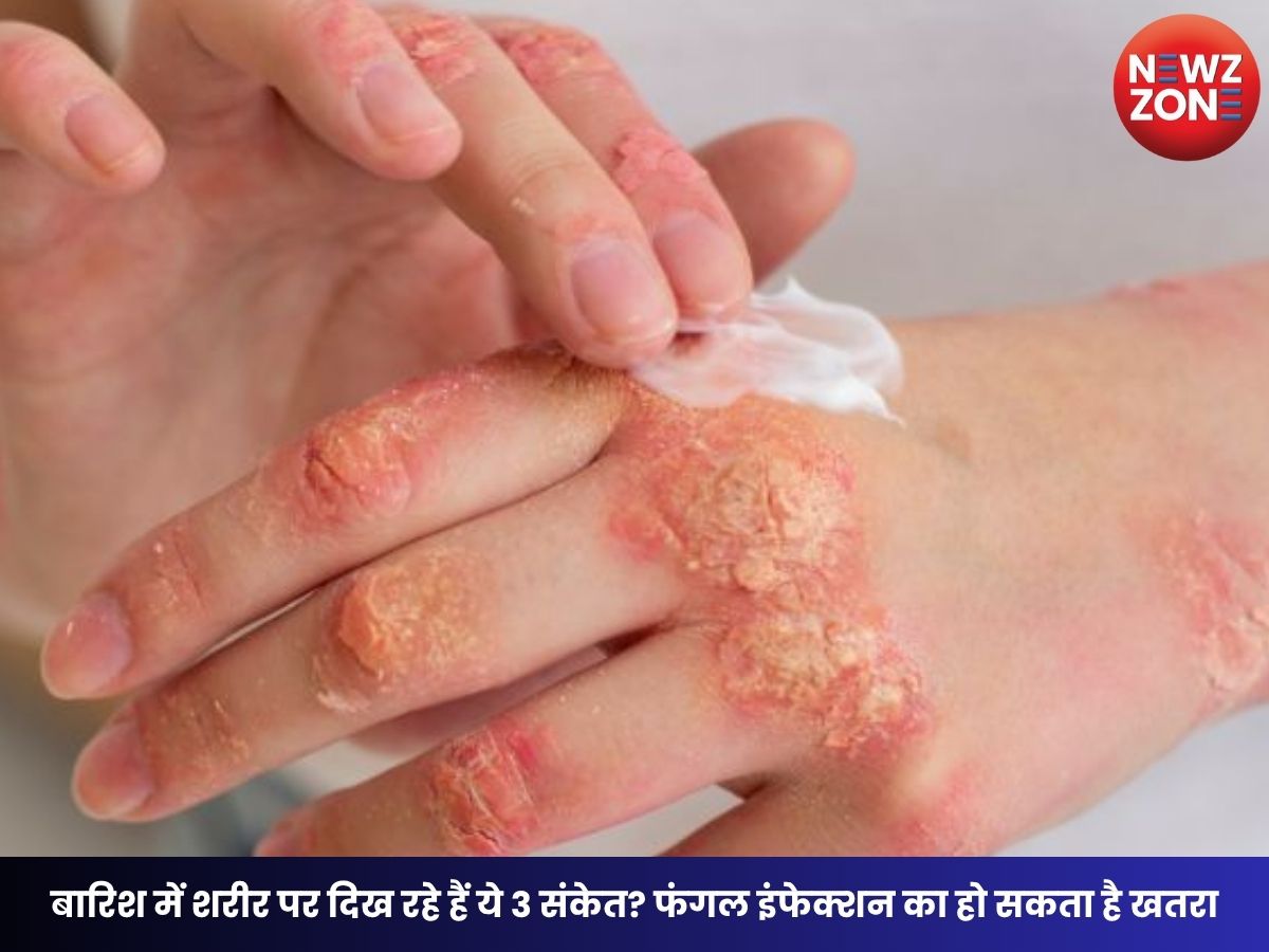 Fungal Infections Alert: बारिश में शरीर पर दिख रहे हैं ये 3 संकेत? फंगल इंफेक्शन का हो सकता है खतरा, जानें बचाव के आसान उपाय