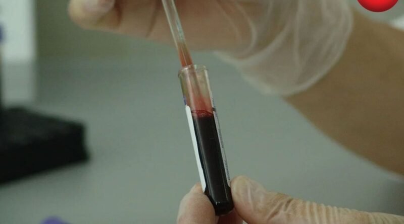 Cancer Detection