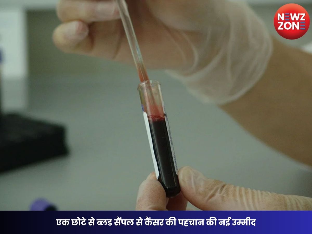 Cancer Detection: एक छोटे से ब्लड सैंपल से कैंसर की पहचान की नई उम्मीद, जानिए क्या है लिक्विड बायोप्सी तकनीक