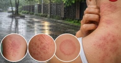 Monsoon Skin Care