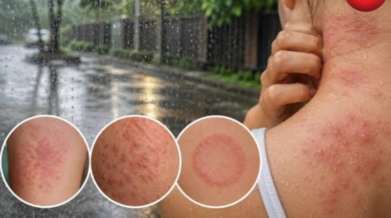 Monsoon Skin Care