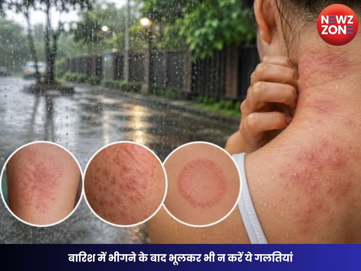 Monsoon Skin Care: बारिश में भीगने के बाद भूलकर भी न करें ये गलतियां, नहीं तो बढ़ सकता है स्किन इंफेक्शन का खतरा