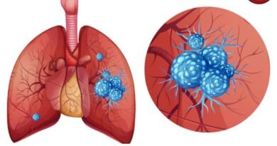 Lung Cancer Symptoms