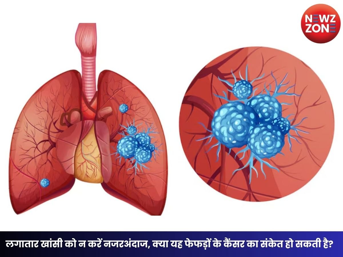 Lung Cancer Symptoms: लगातार खांसी को न करें नजरअंदाज, क्या यह फेफड़ों के कैंसर का संकेत हो सकती है? जानें चेतावनी वाले लक्षण