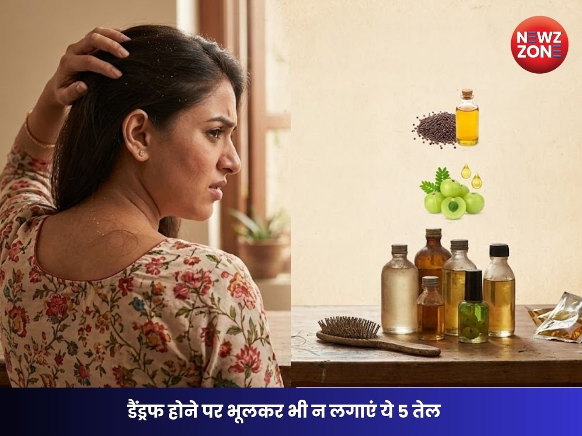 Hair Oiling Myths: डैंड्रफ होने पर भूलकर भी न लगाएं ये 5 तेल, बढ़ सकती है खुजली और बाल झड़ने की समस्या