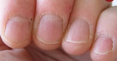 Nail Care