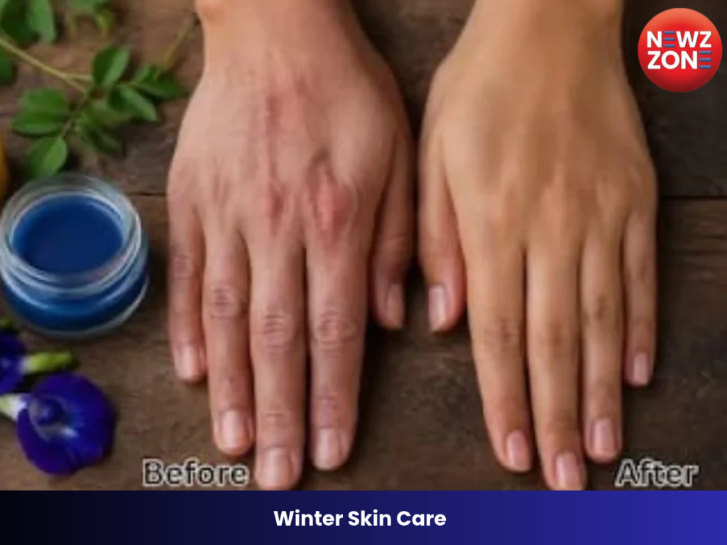 Winter Skin Care